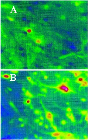 Intracellular Calcium in Human Neuronal Cell Cultures