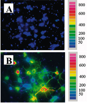 Intracellular Calcium