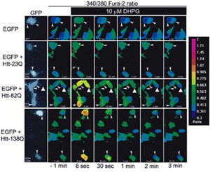 Ca2+ Imaging of Rat Medium Spiny Neurons Ca2+ Imaging of Rat Medium Spiny Neurons